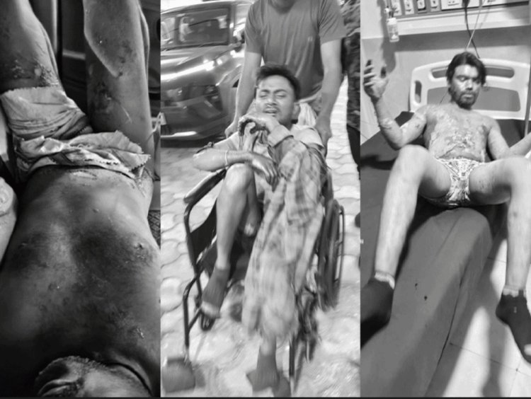 सुरक्षा में लापरवाही या तकनीकी खराबी? आयरन प्लांट में हादसे से 4 मजदूर झुलसे